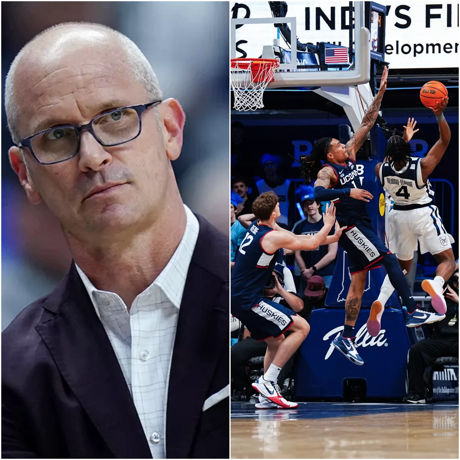 BREAKING: UConn Huskies Star Guard Suffers Season-Ending Injury After Collision in Butler Game